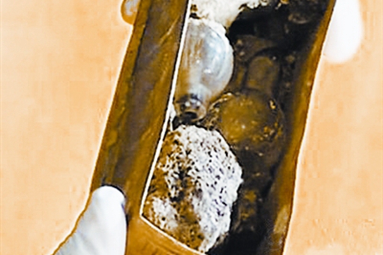 Buddha's Parietal Relic Nanjing Niushoushan